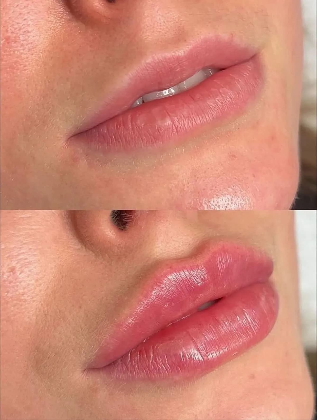 Fuller Lips After Lip Tint